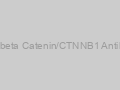 Anti-beta Catenin/CTNNB1 Antibody